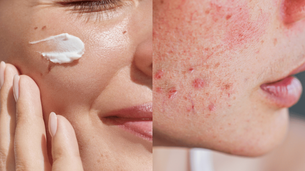 Nebezpečná kozmetika sa môže vyskytnúť aj na Slovensku