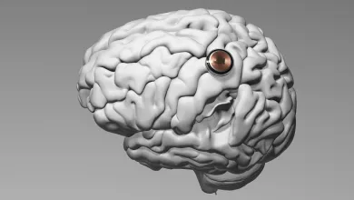 Pacient sa podľa slov spoločnosti zotavuje dobre